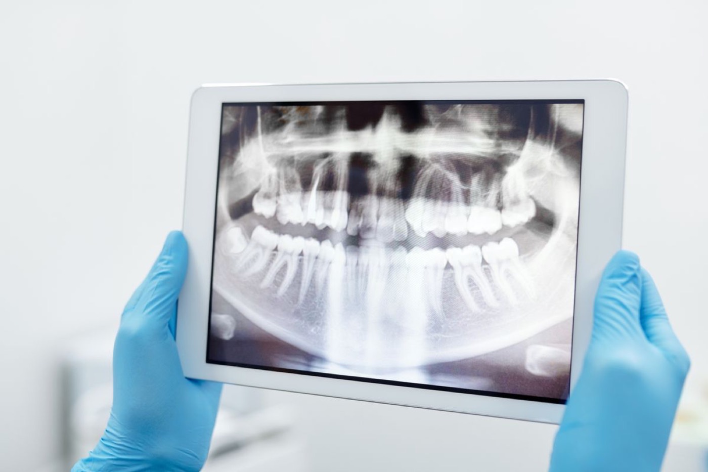 A clinician reviewing a panoramic dental x-ray on a tablet