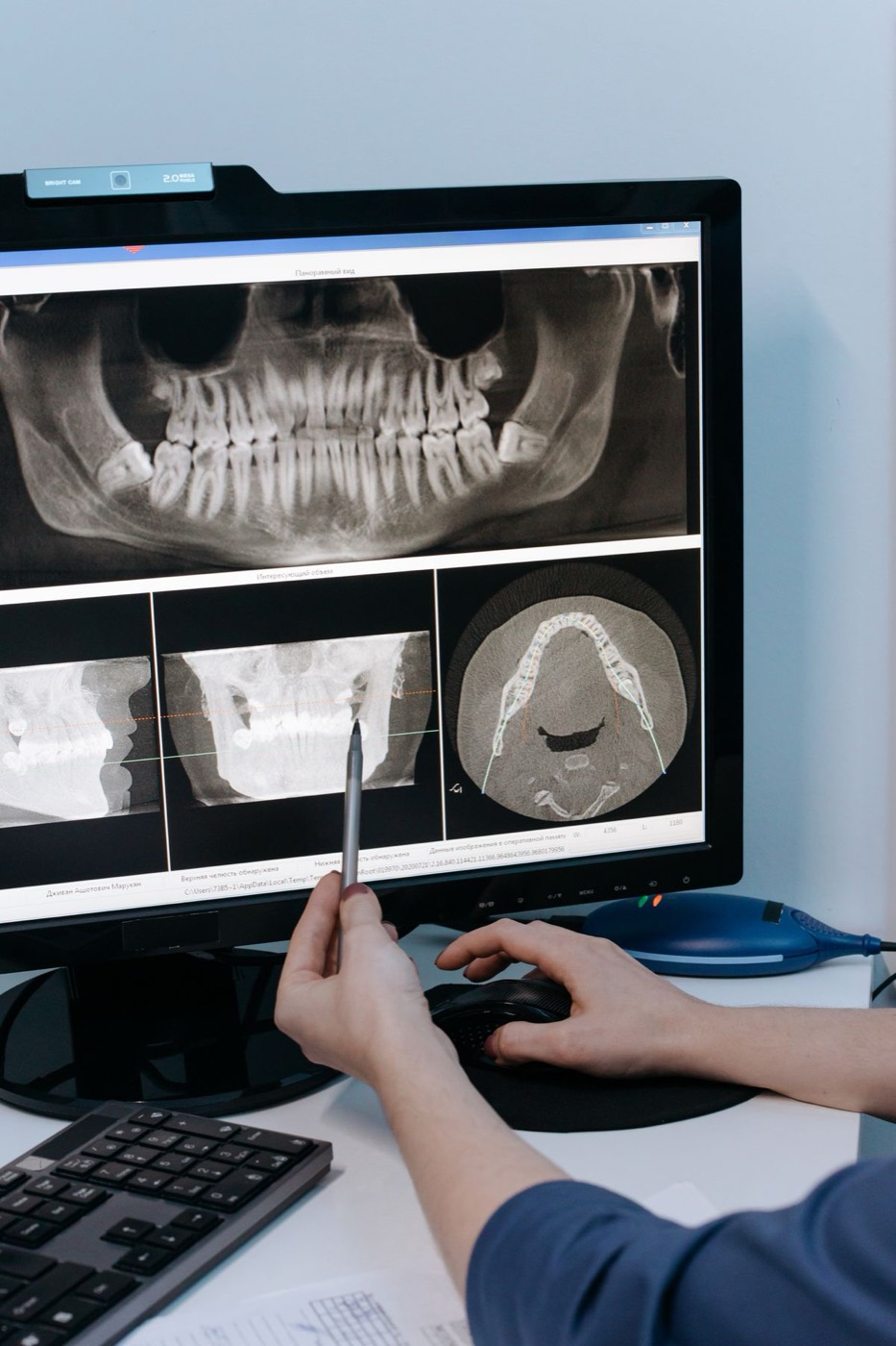 A clinician reviewing a jawbone scan on a computer screen